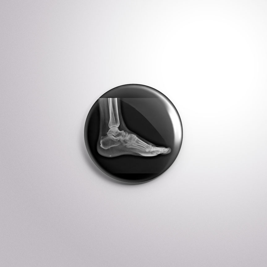 C49 Interchangeable Badge Button X-ray Foot